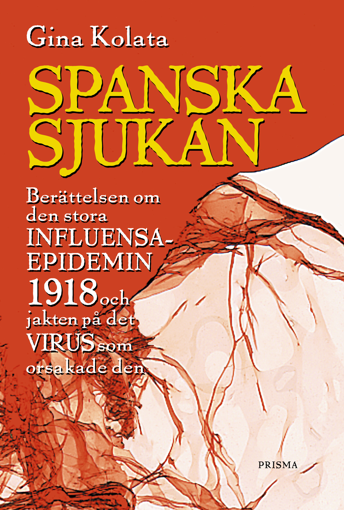 Spanska sjukan